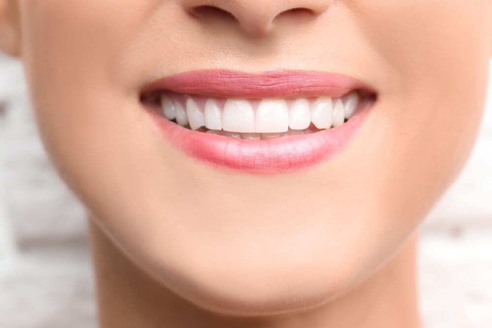 Composite Bonding [GUIDE]: Fix Teeth Stains, Gaps, Shape & More