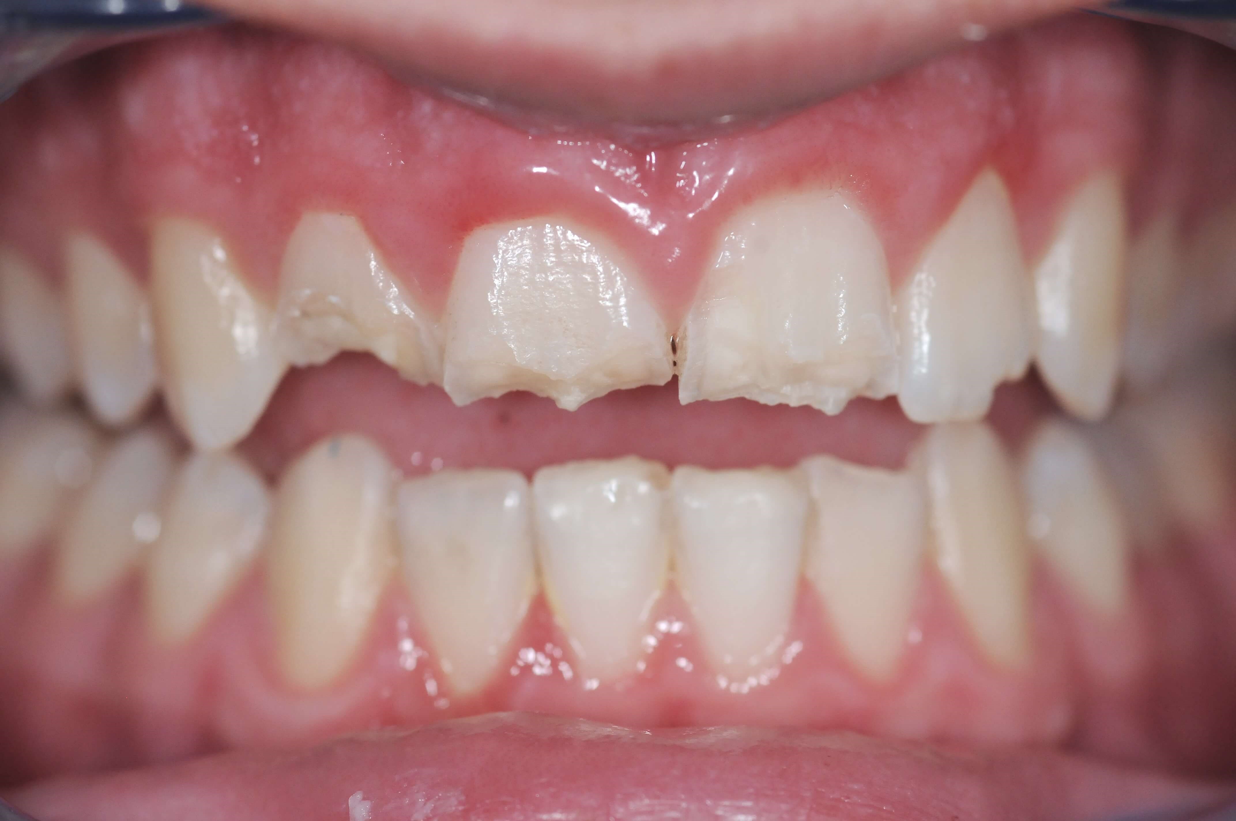 Before Image