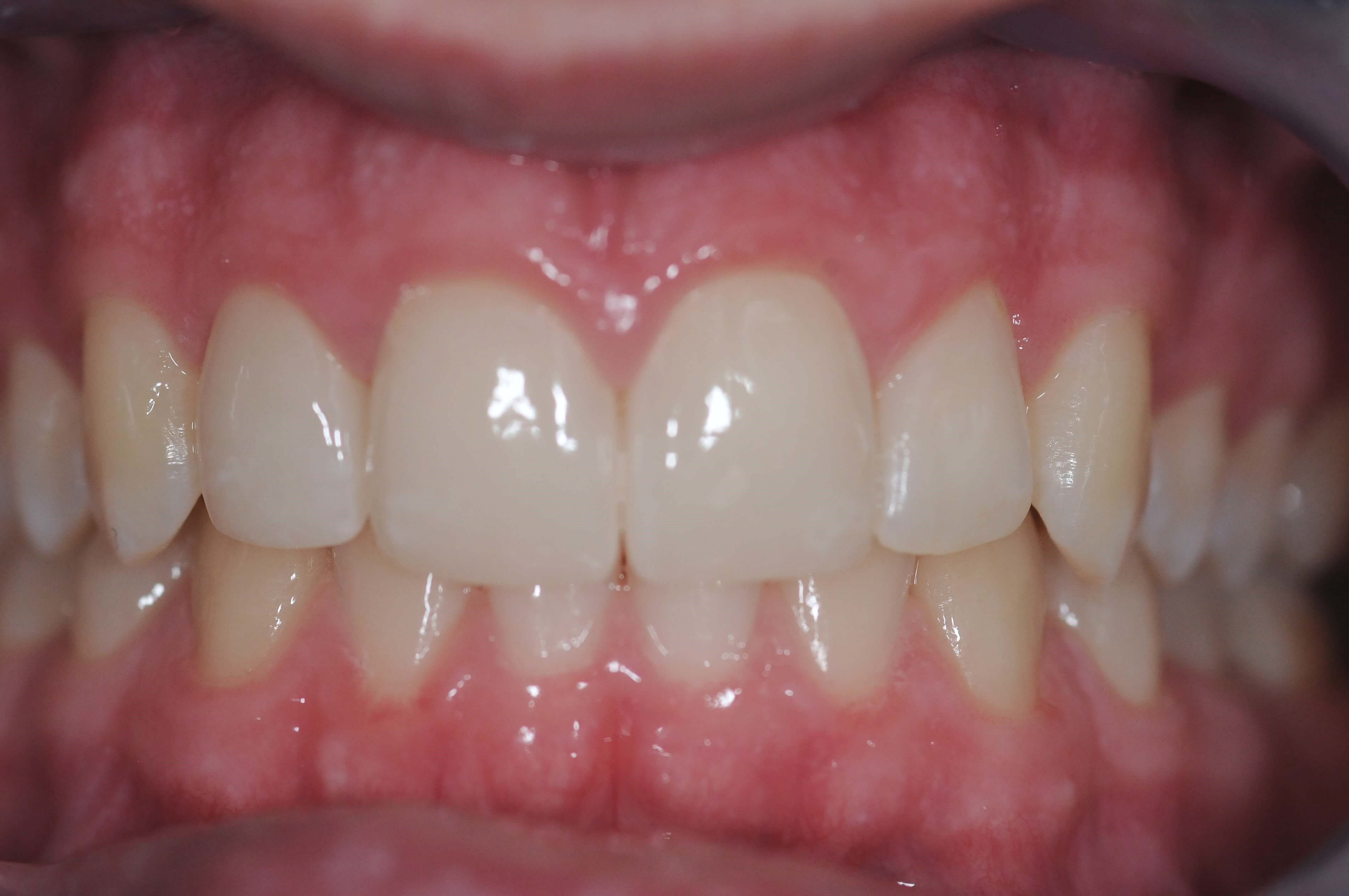 After Image