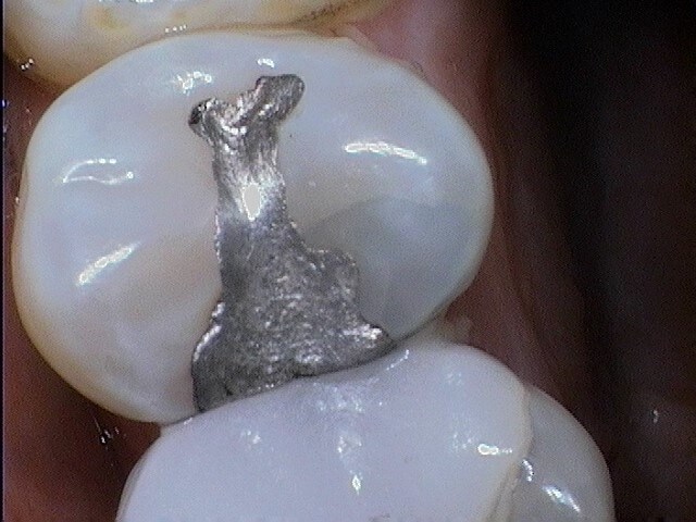 Before Image