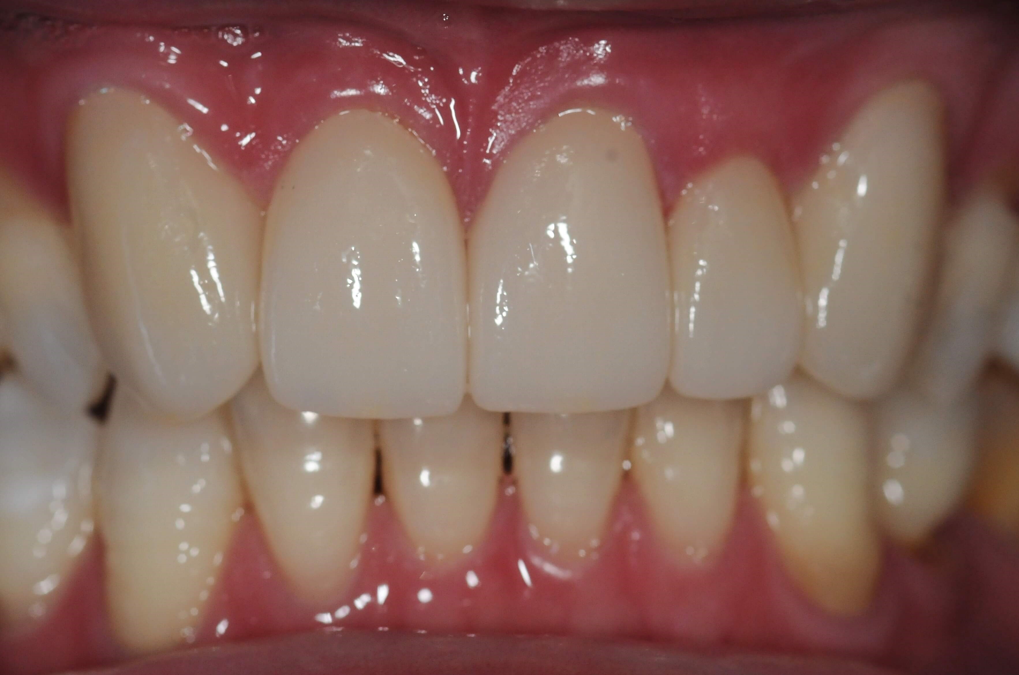After Image