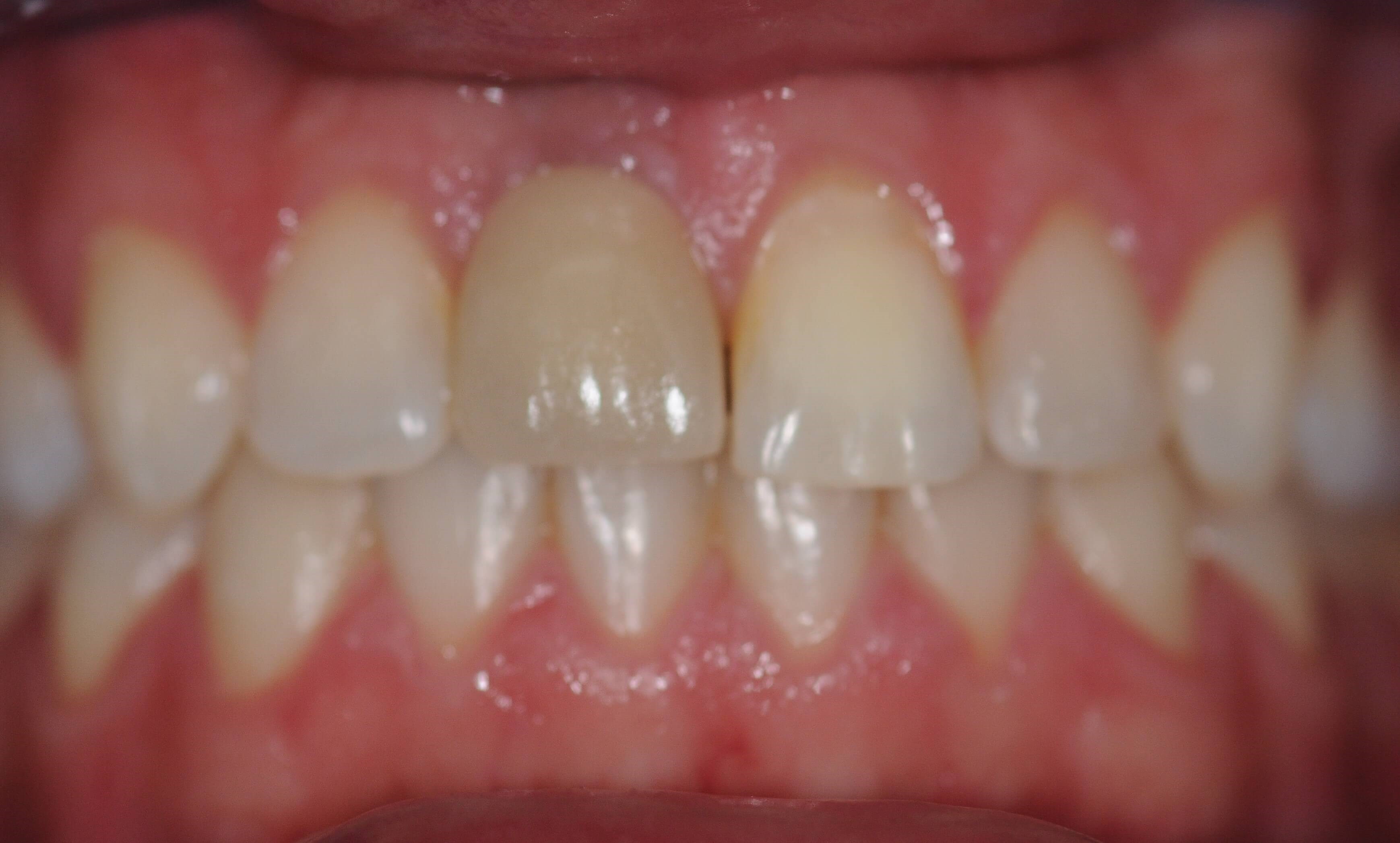 Before Image