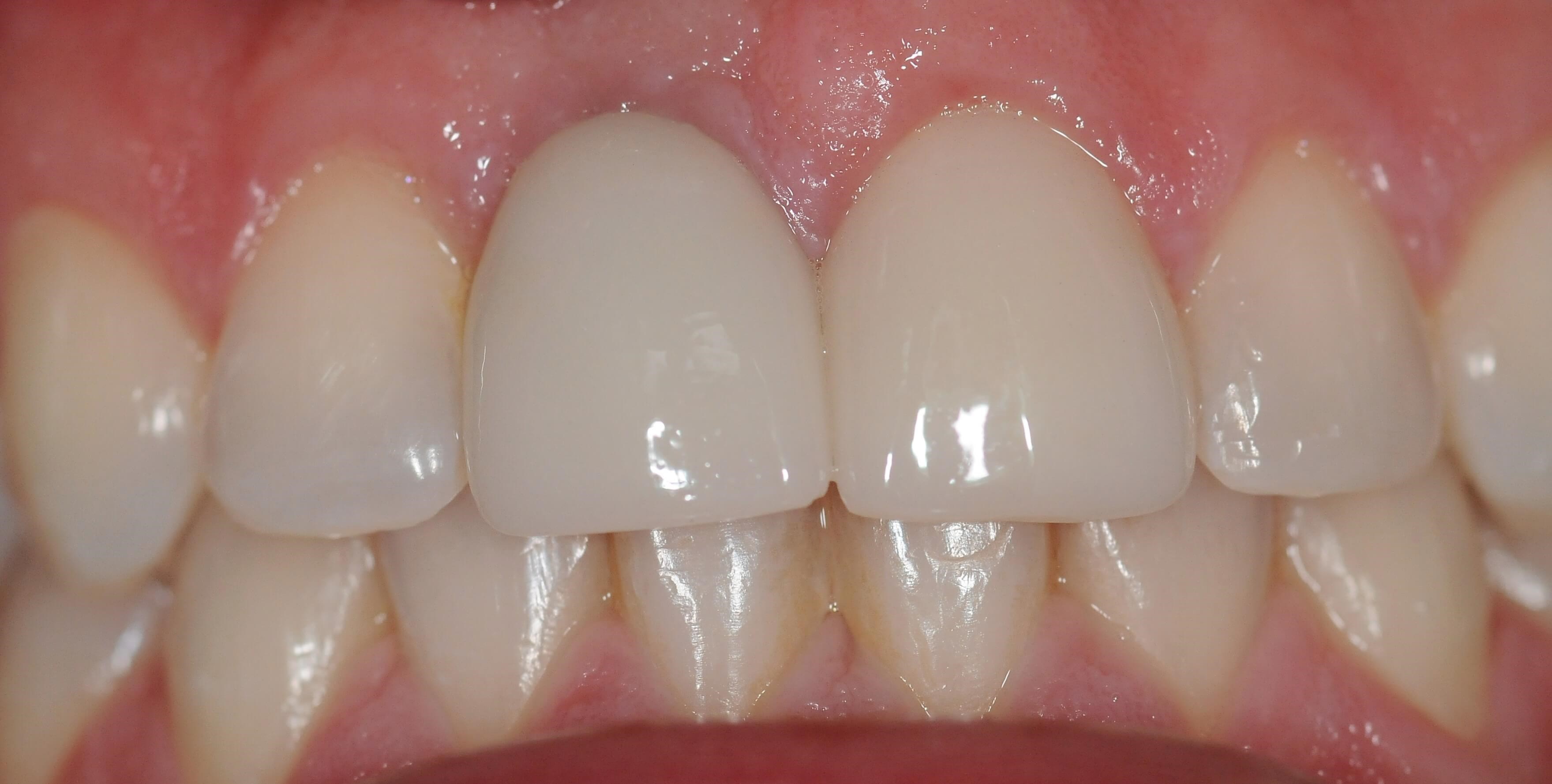 After Image