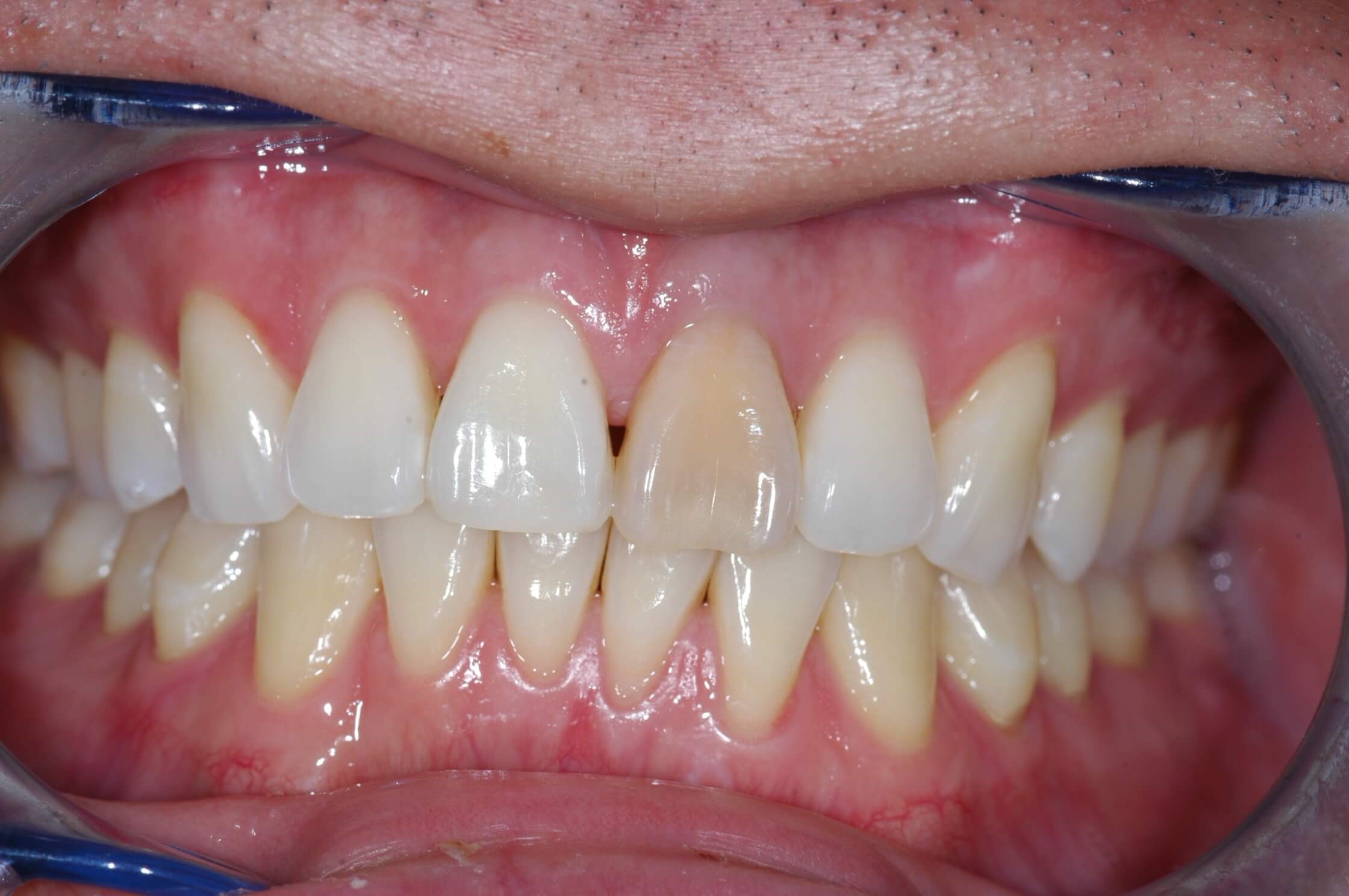 Before Image