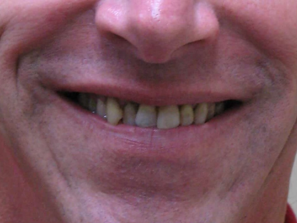 Face View Before