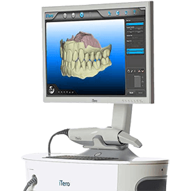 3D Digital Impressions