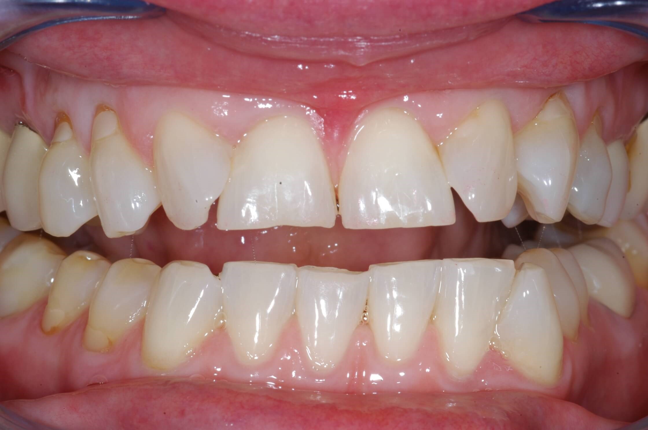 Full View Before
