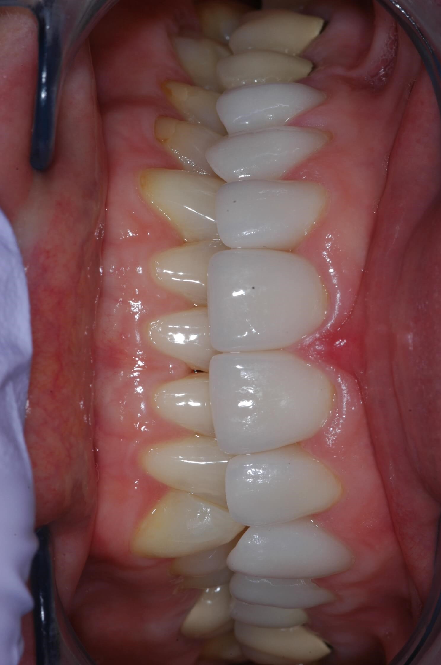 Full View After