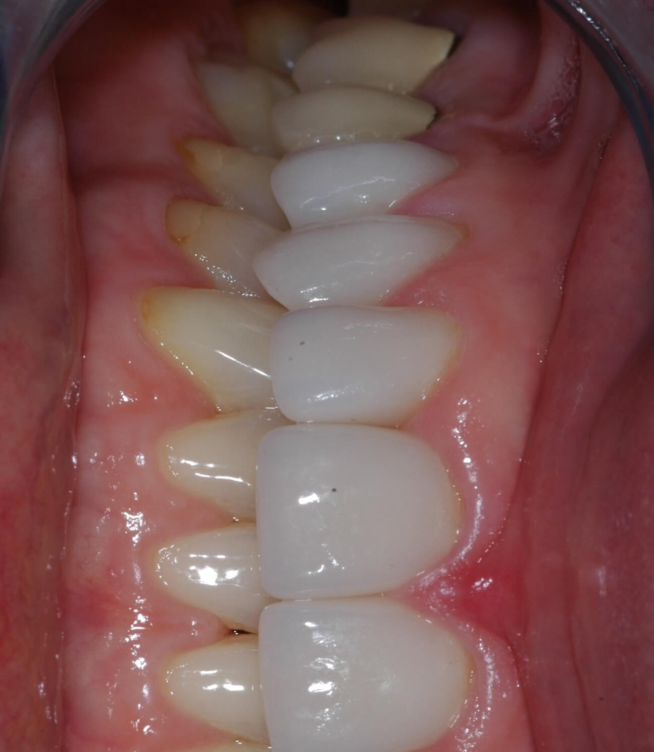 Full View After