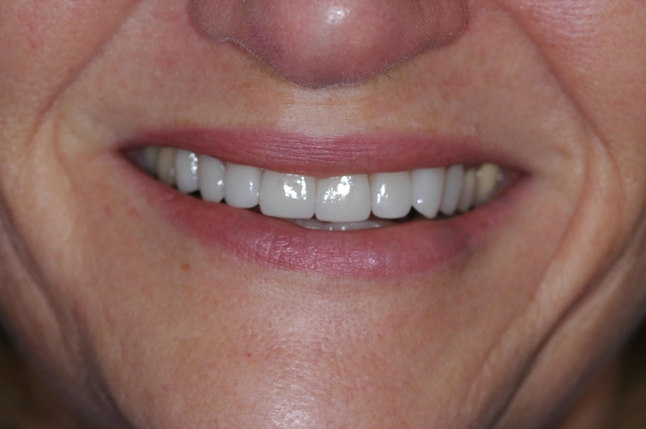 After Image