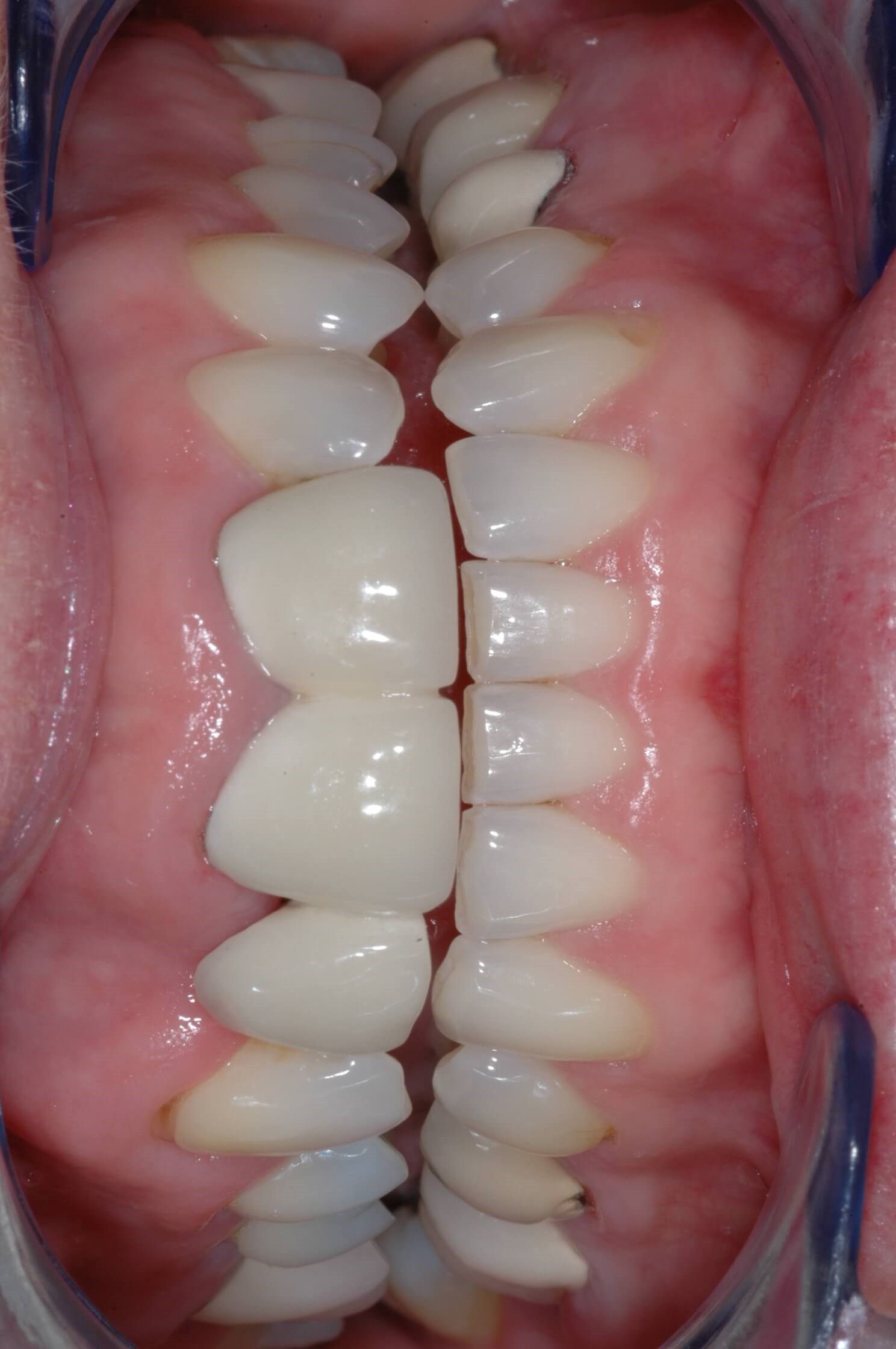 Before Image