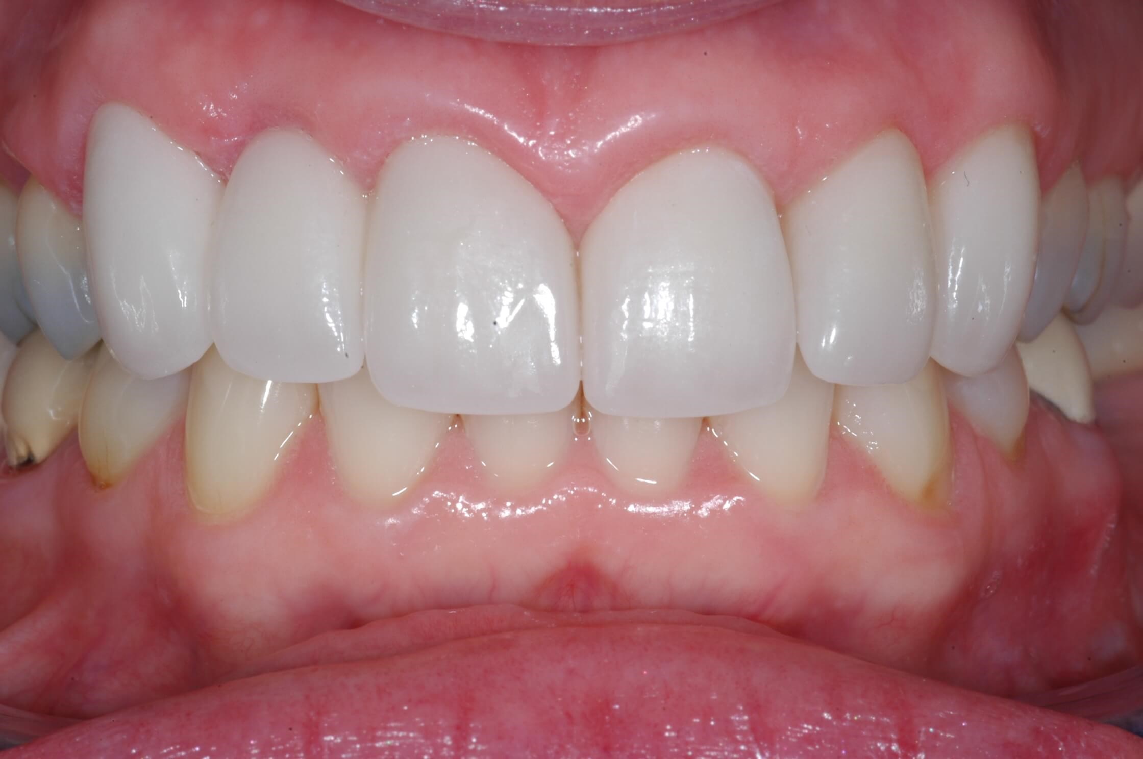 After Image