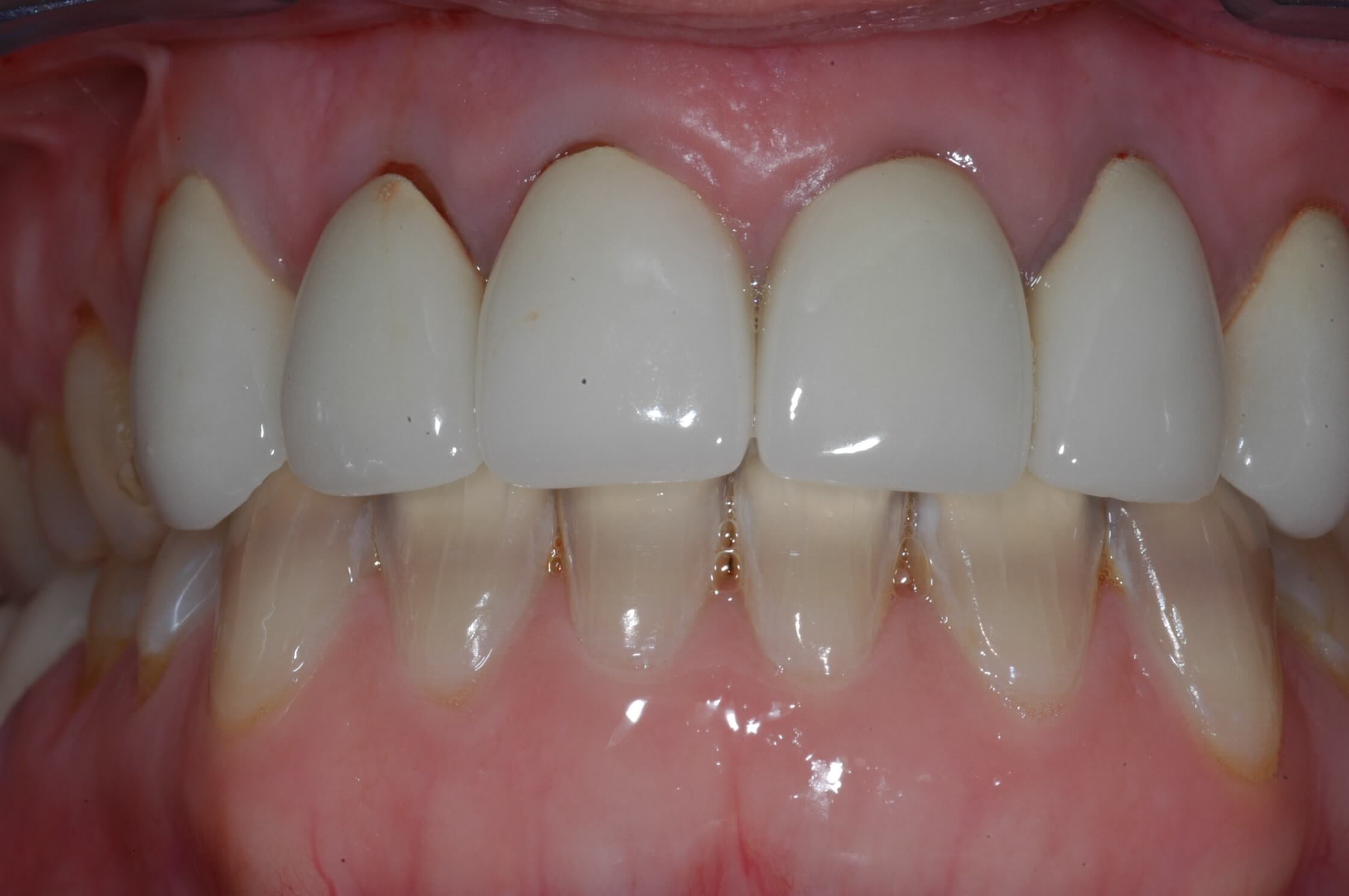 Before Image