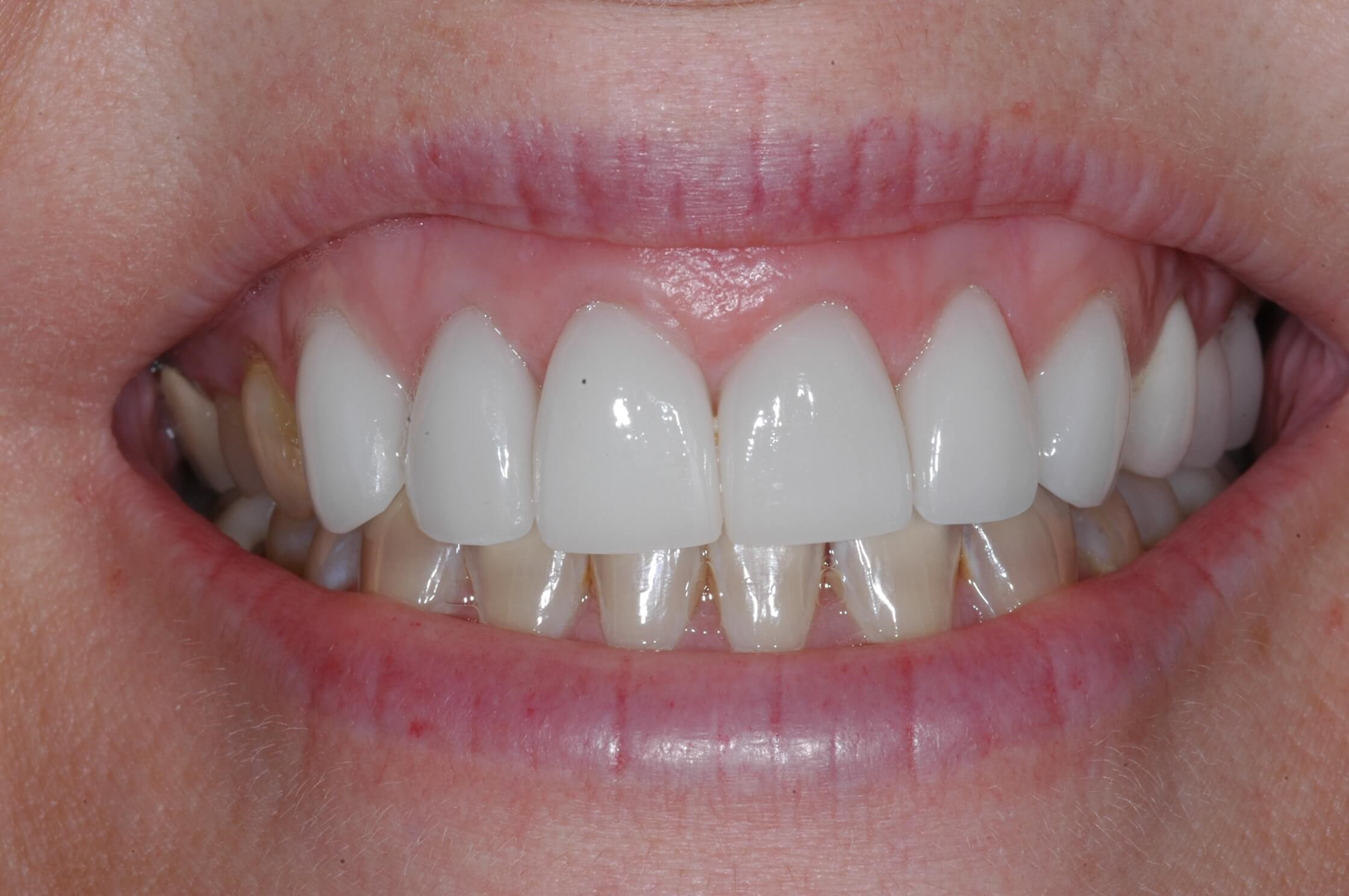 After Image