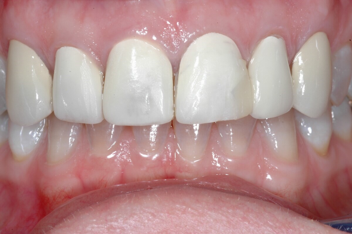 Before Image