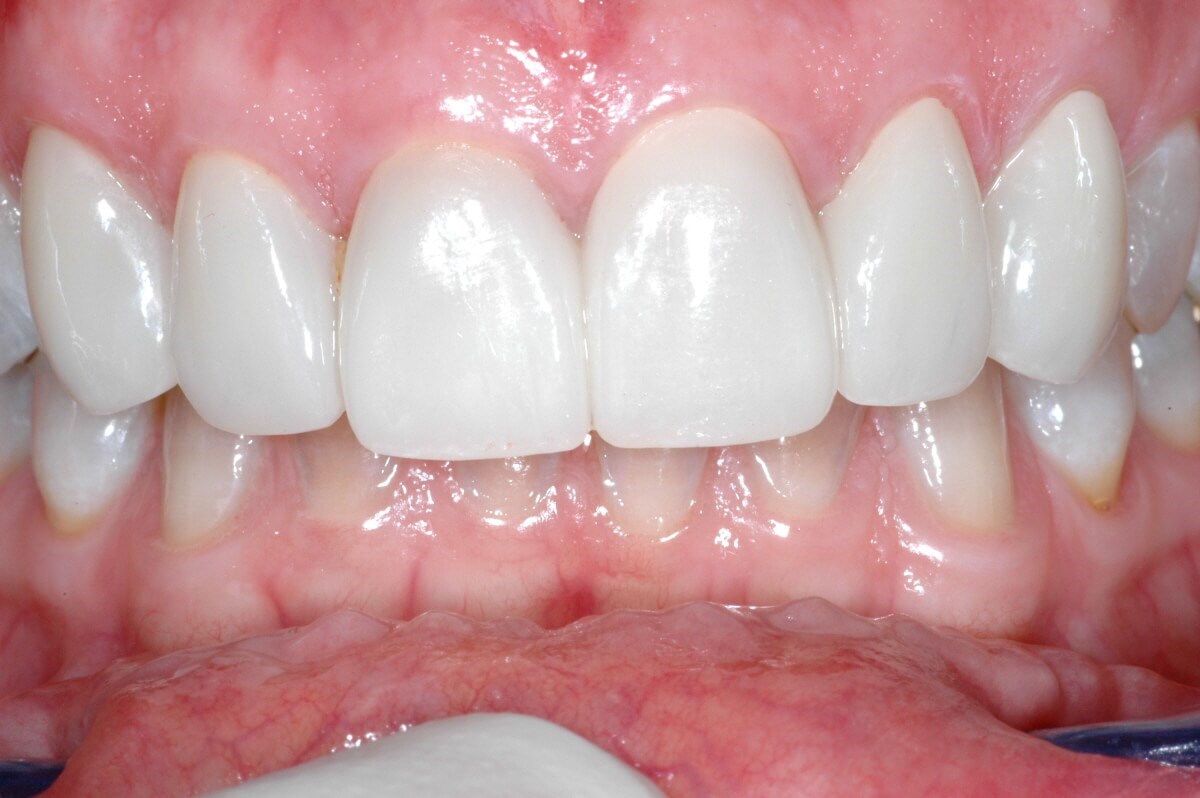 After Image