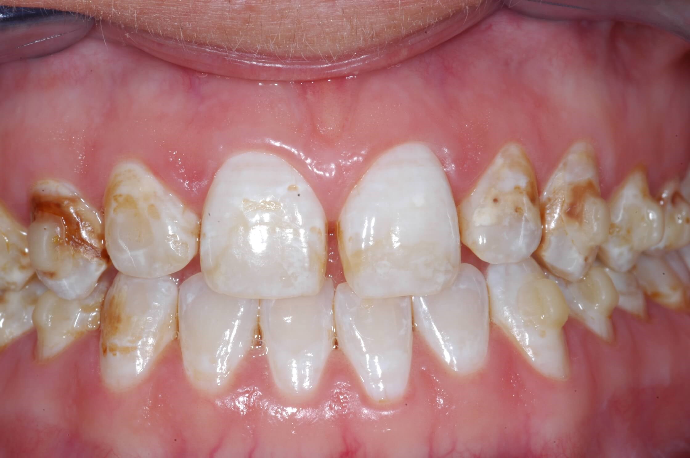 Before Image