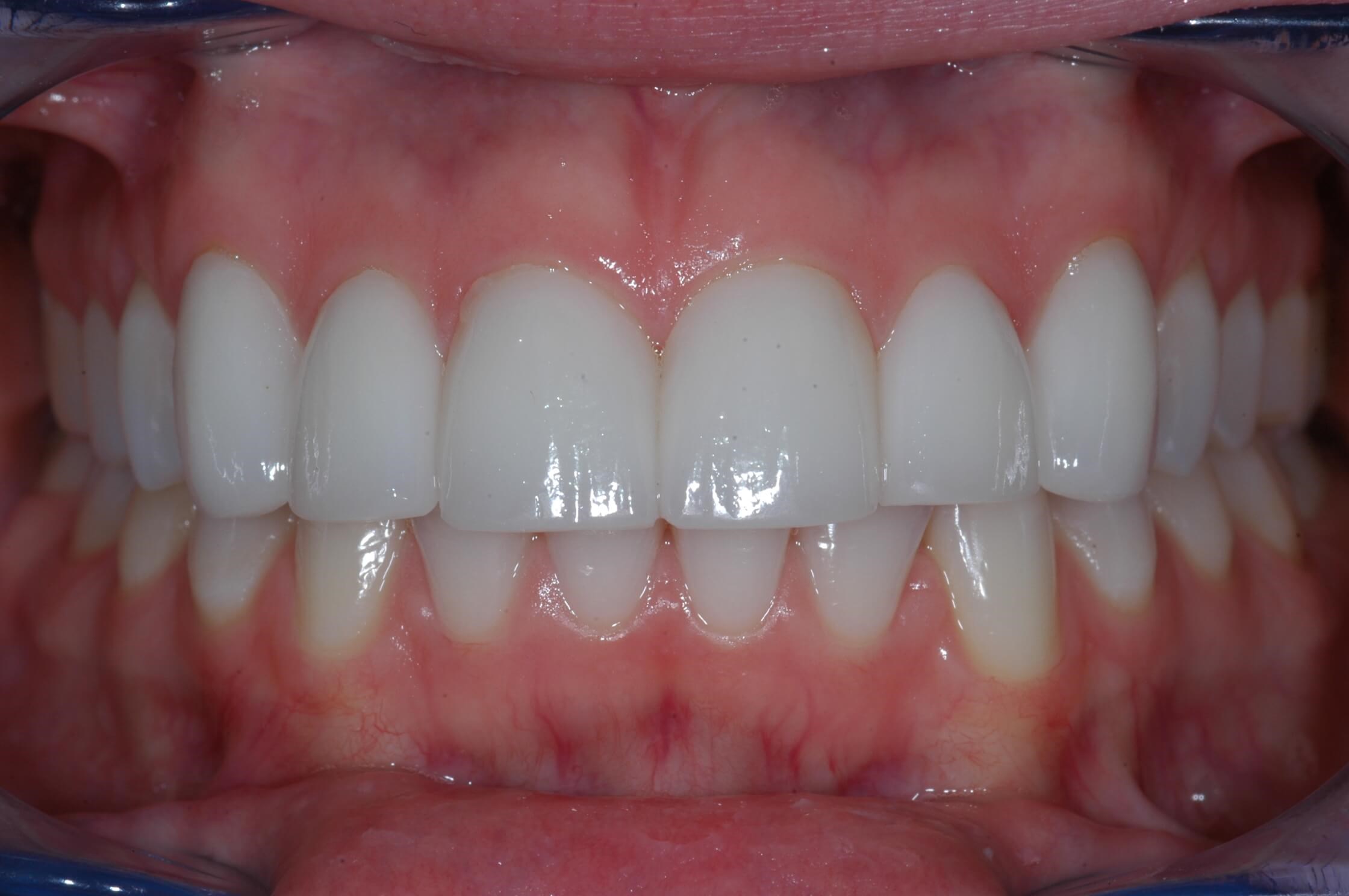 Before Image