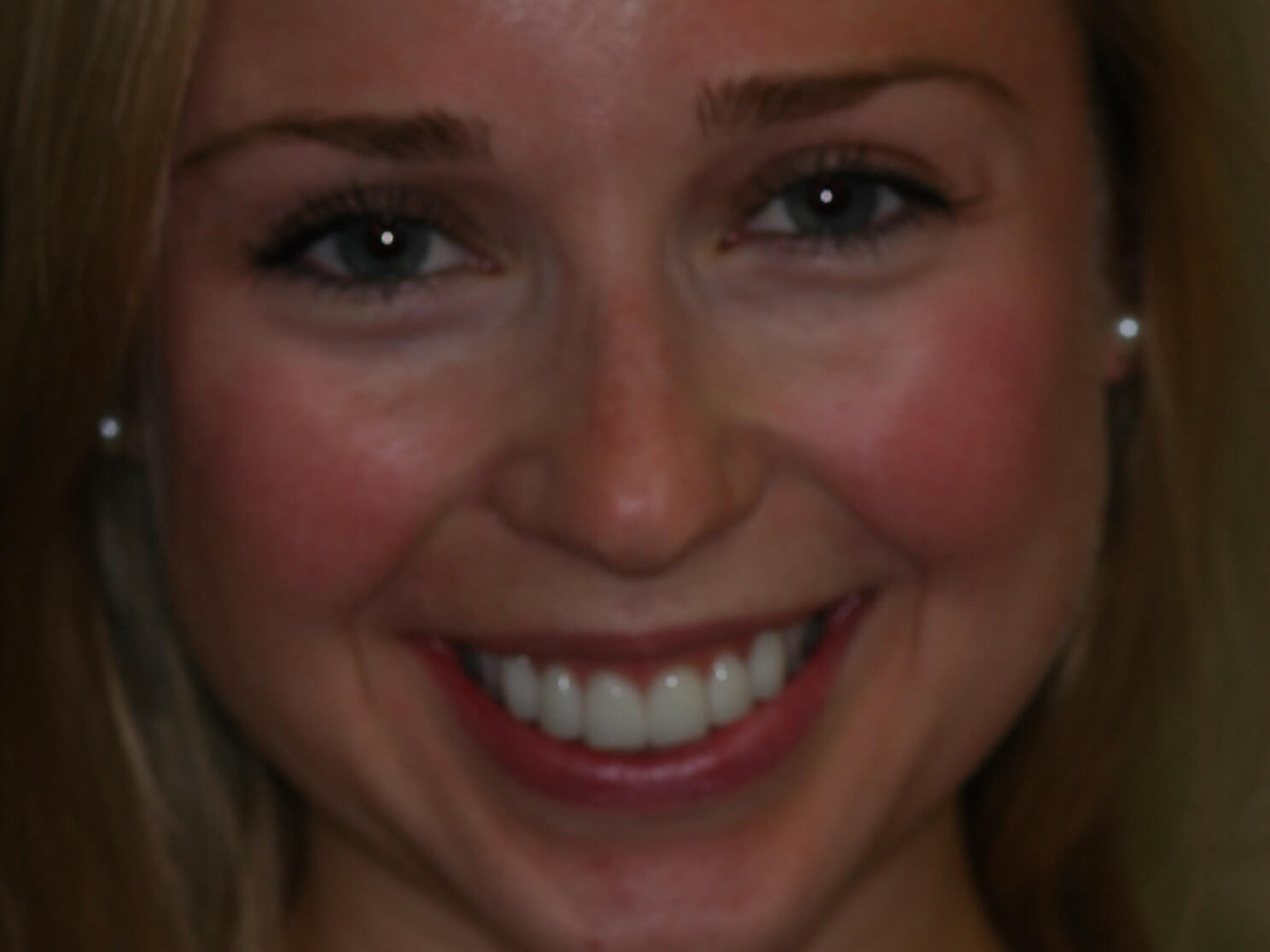 Full Smile Before