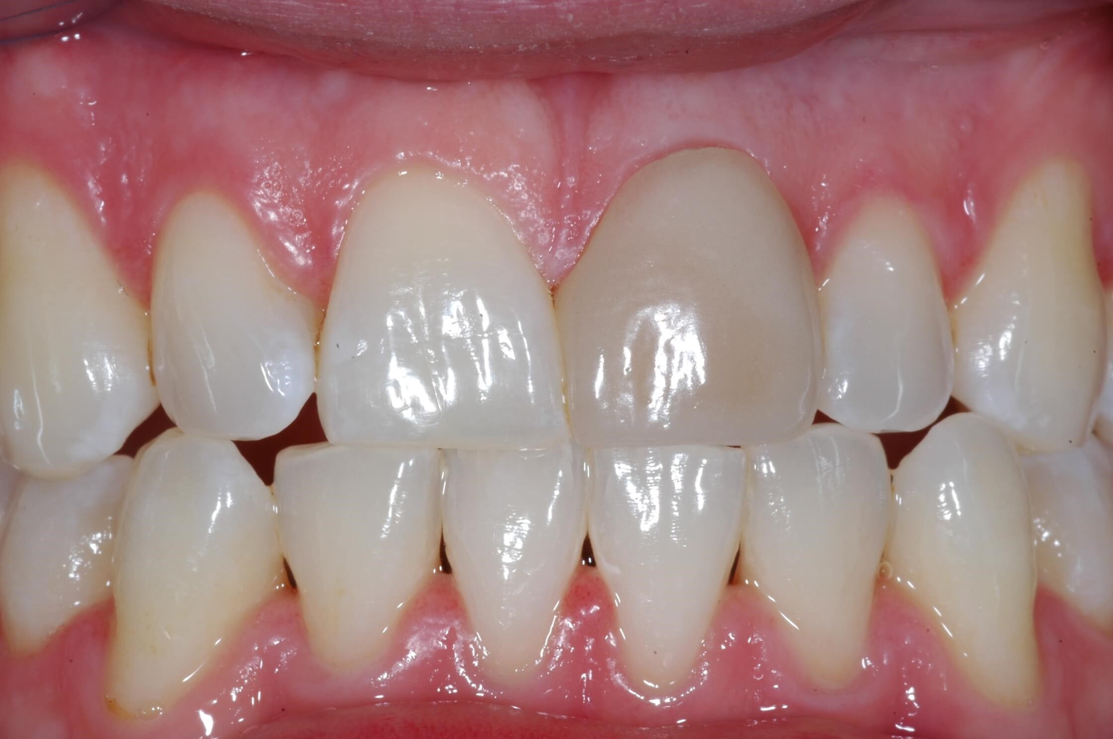 Before Image