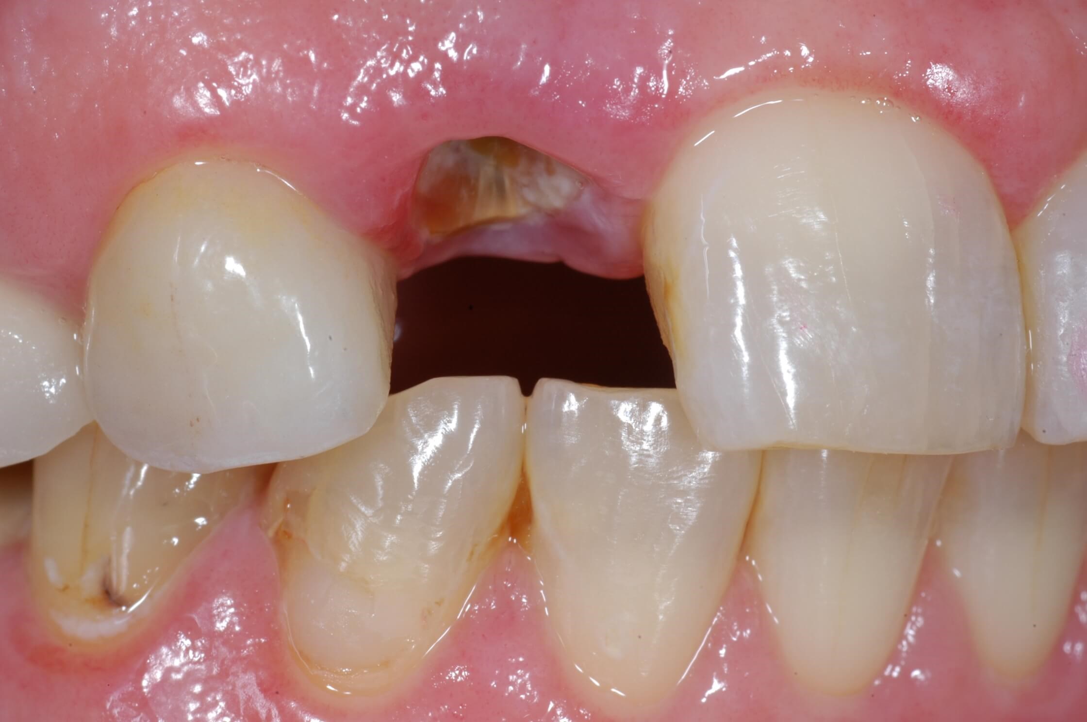 Before Image