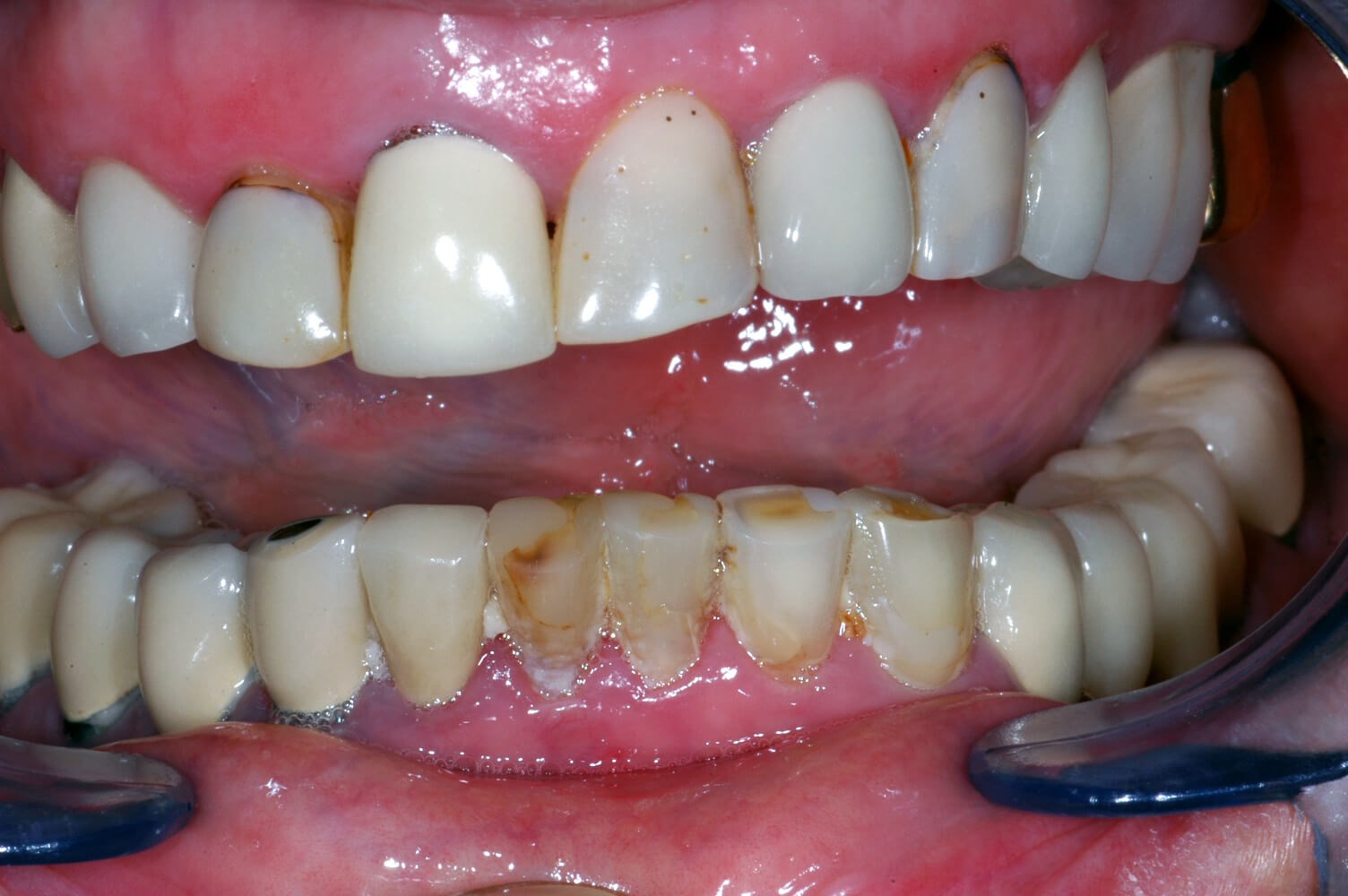 Before Image