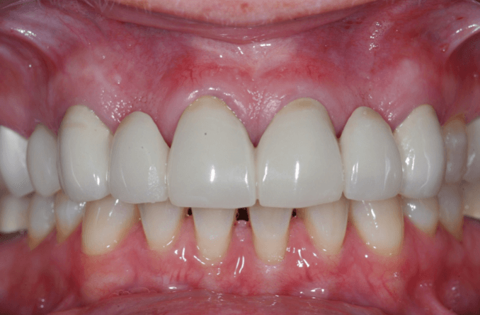 Before Image