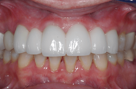 After Image