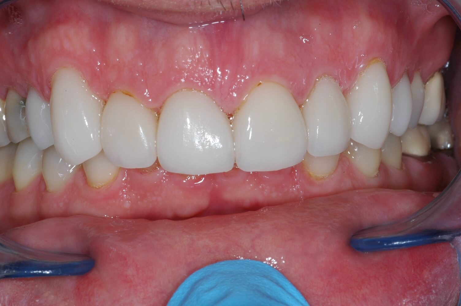 Before Image