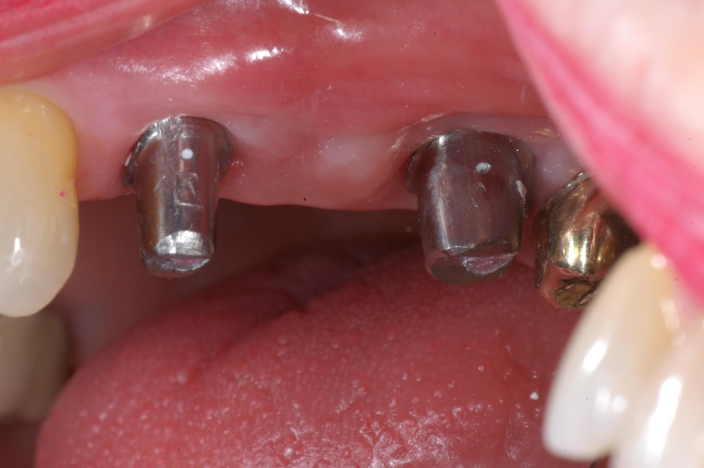 Before Image