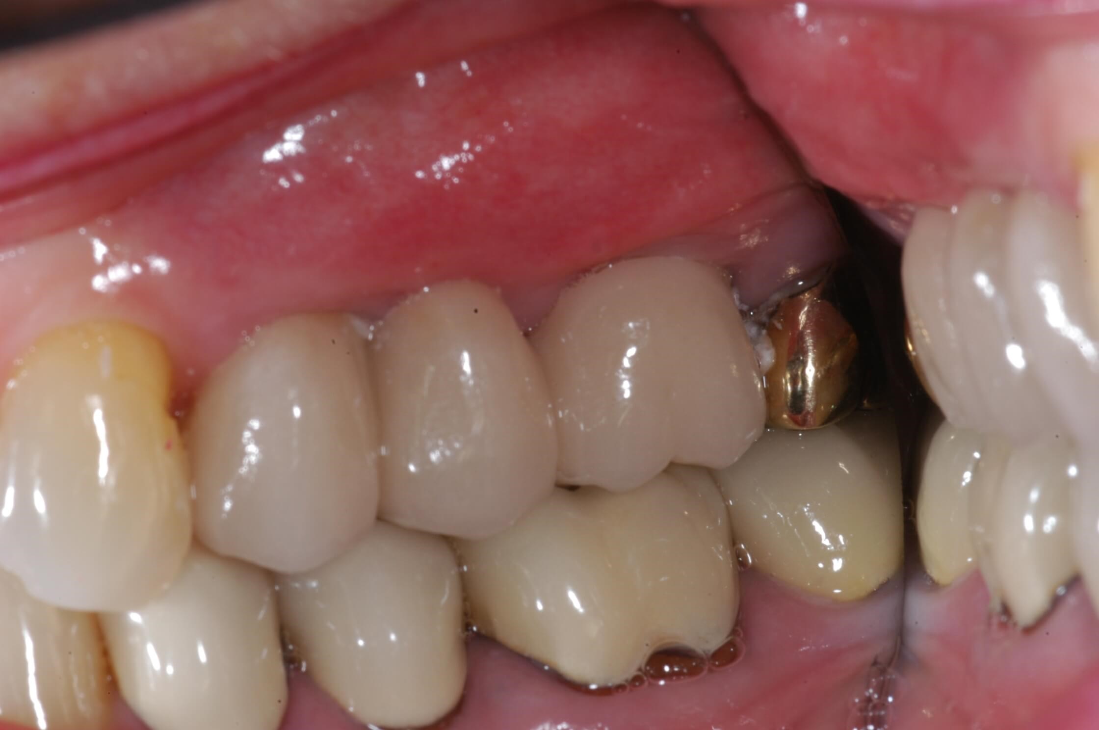 After Image