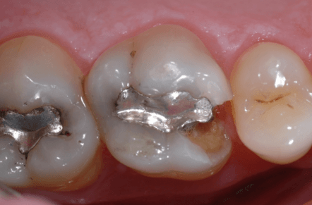 Before Image
