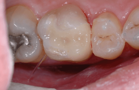After Image