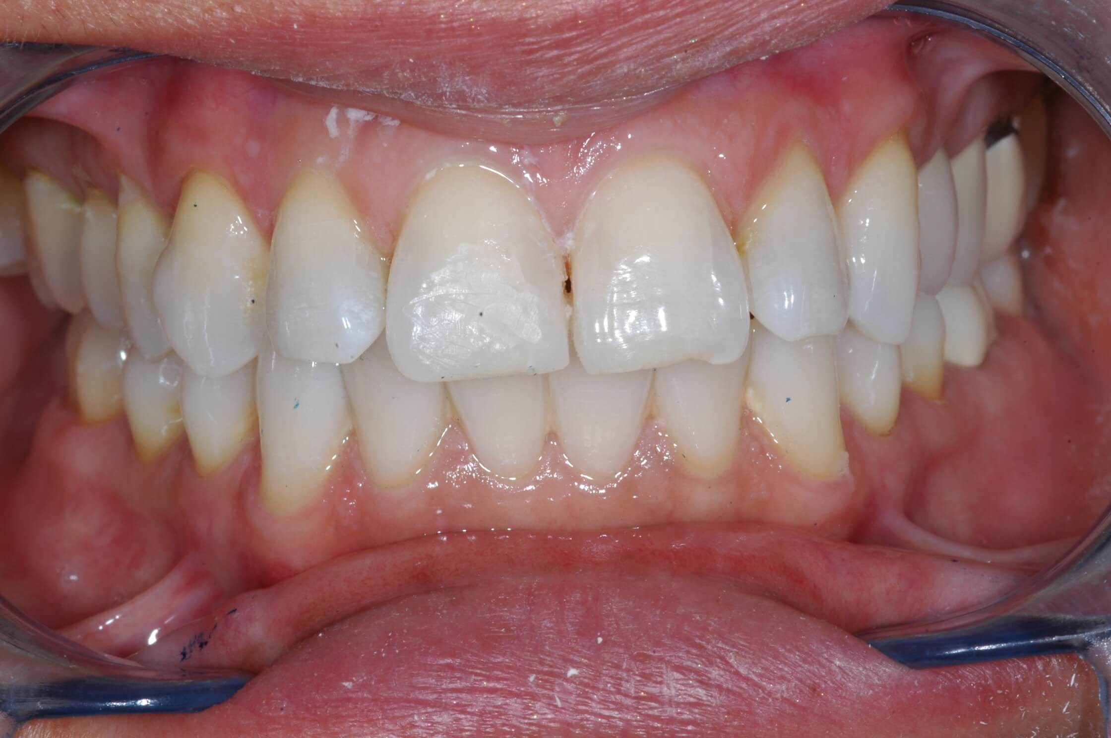 Before Image