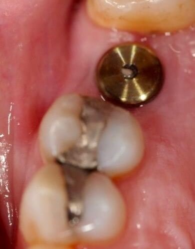Before Image
