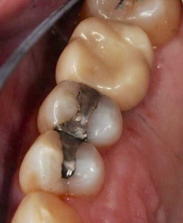After Image