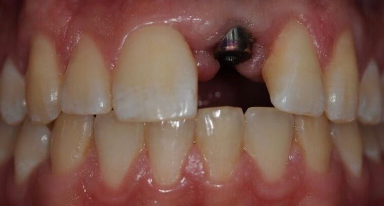 Before Image