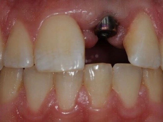 Dental Makeover Before