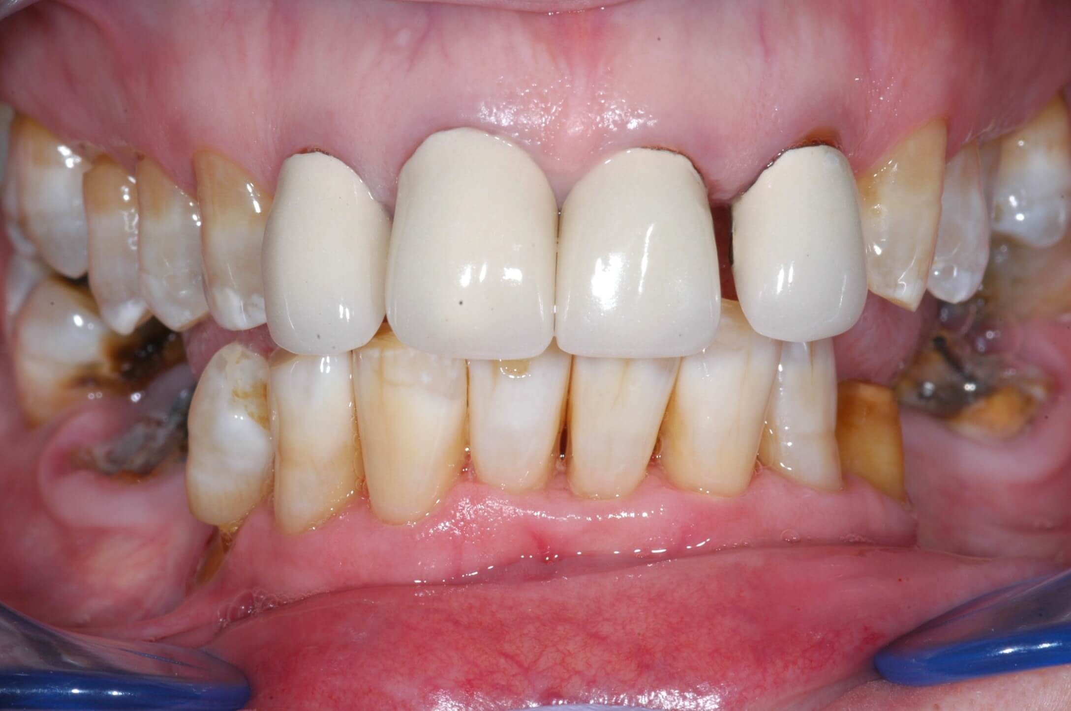 Before Image