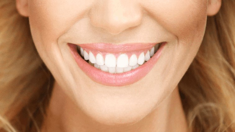 white teeth
