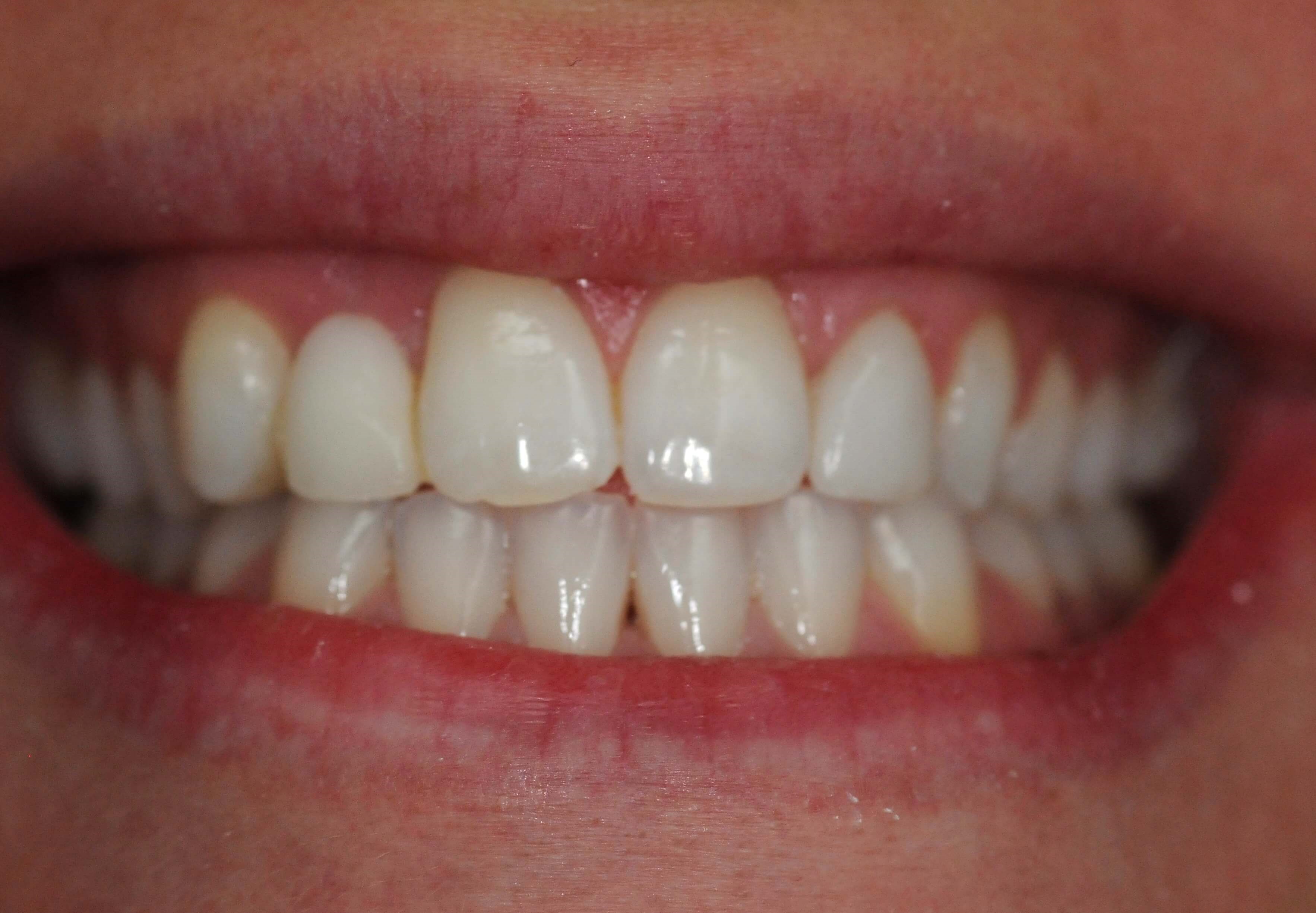 Before Image