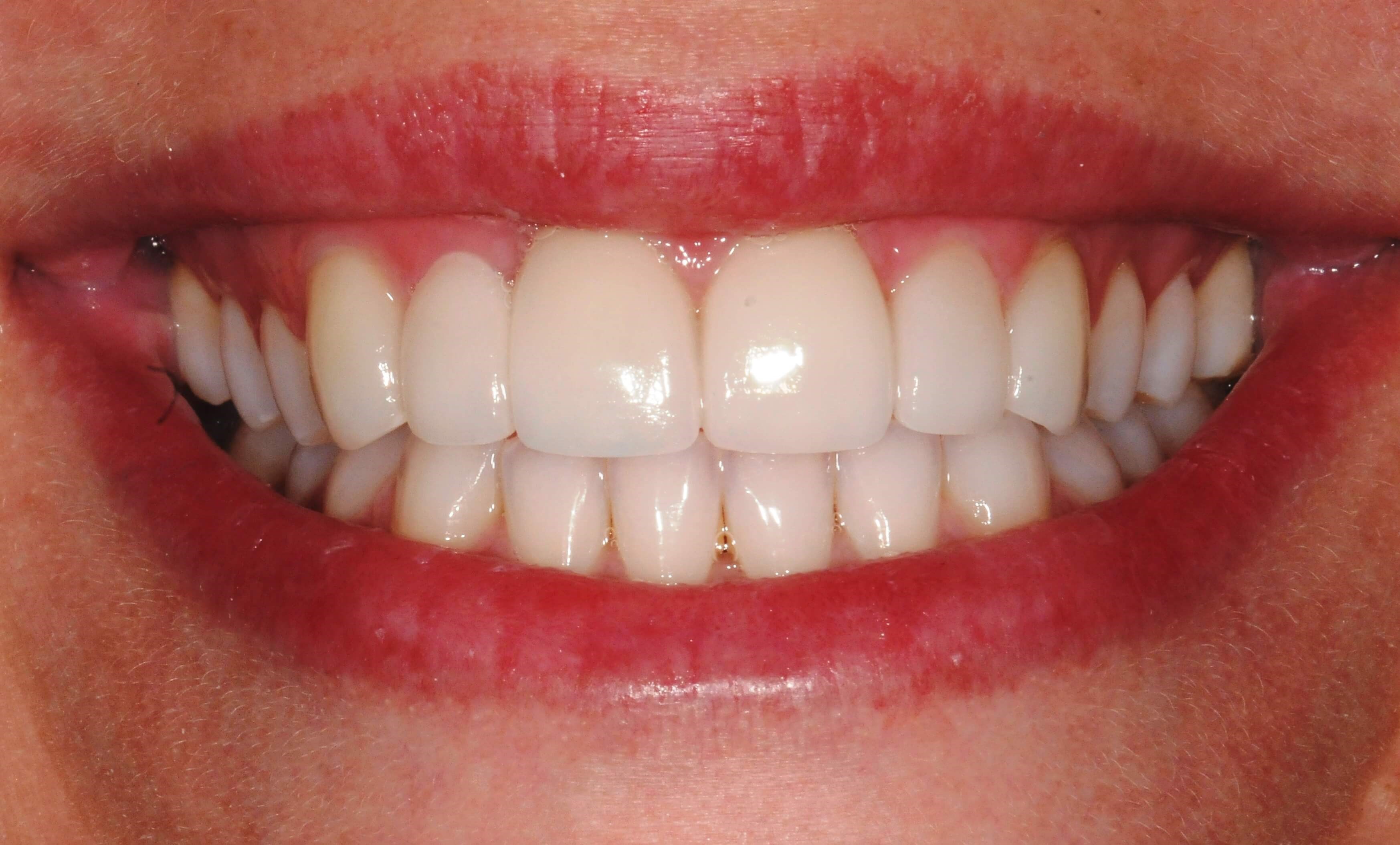 After Image