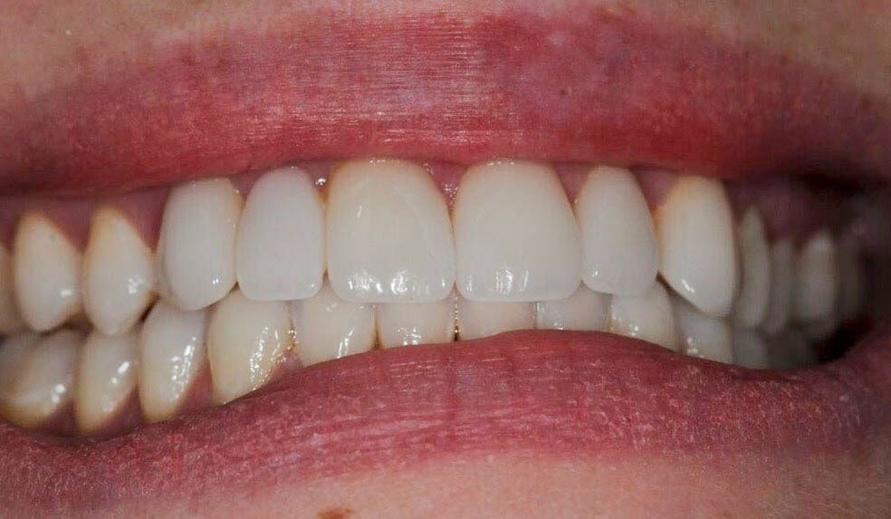 Before Image