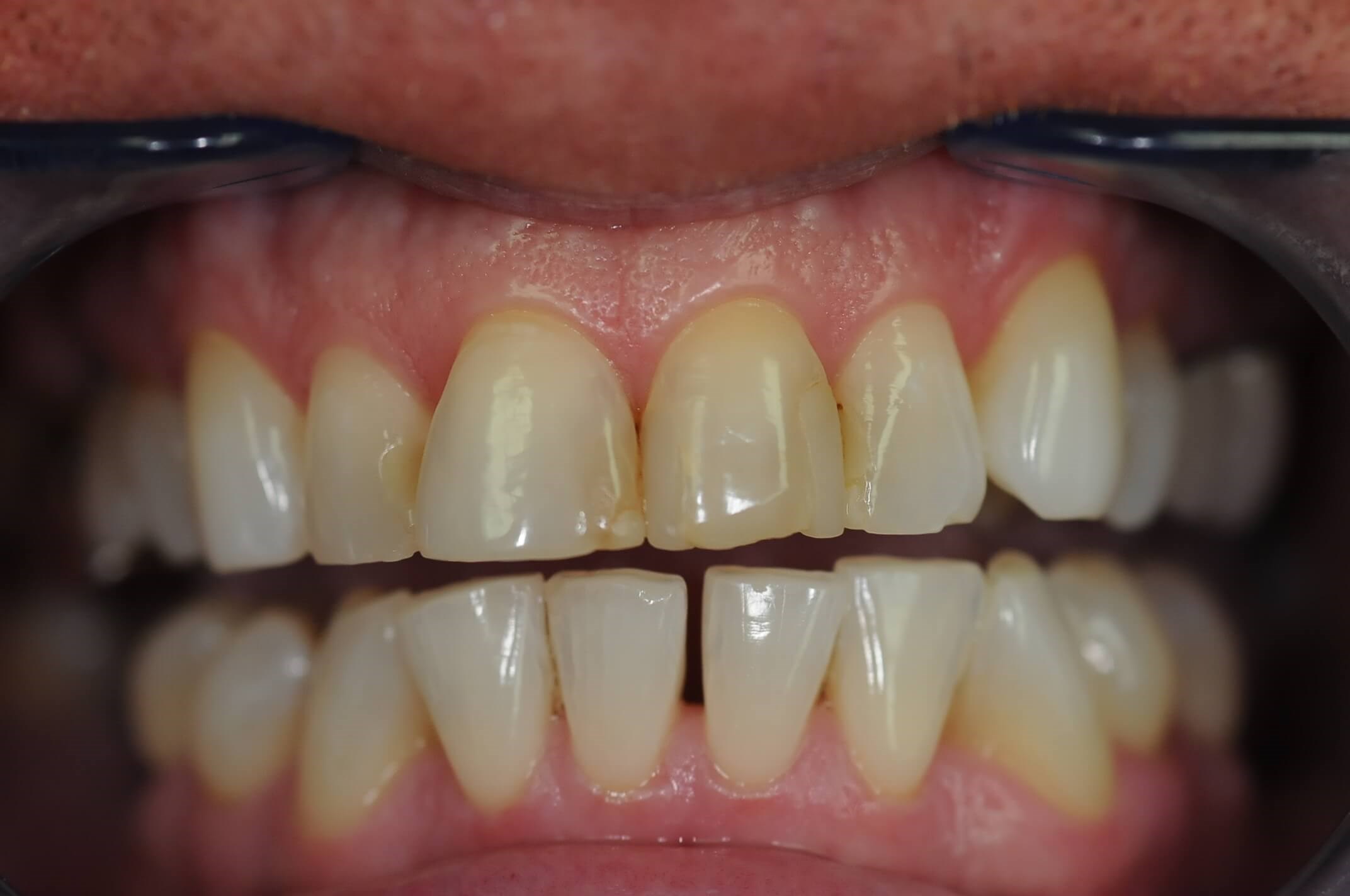 Before Image