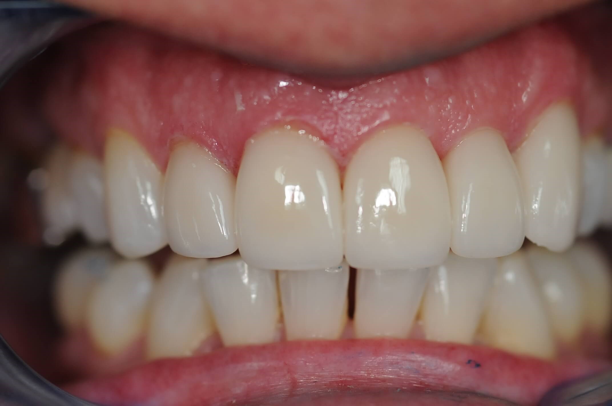 After Image