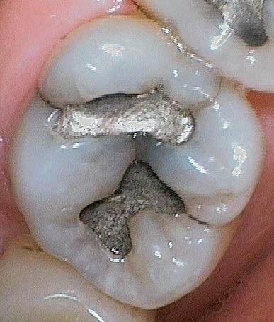 Before Image