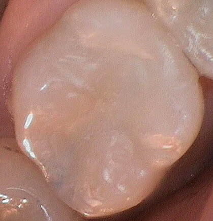 After Image