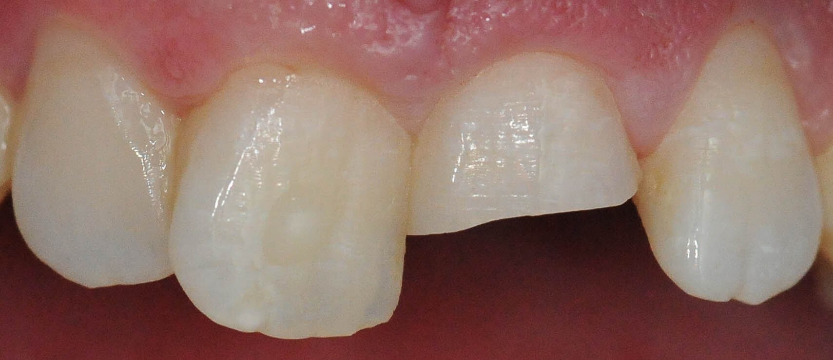 Before Image