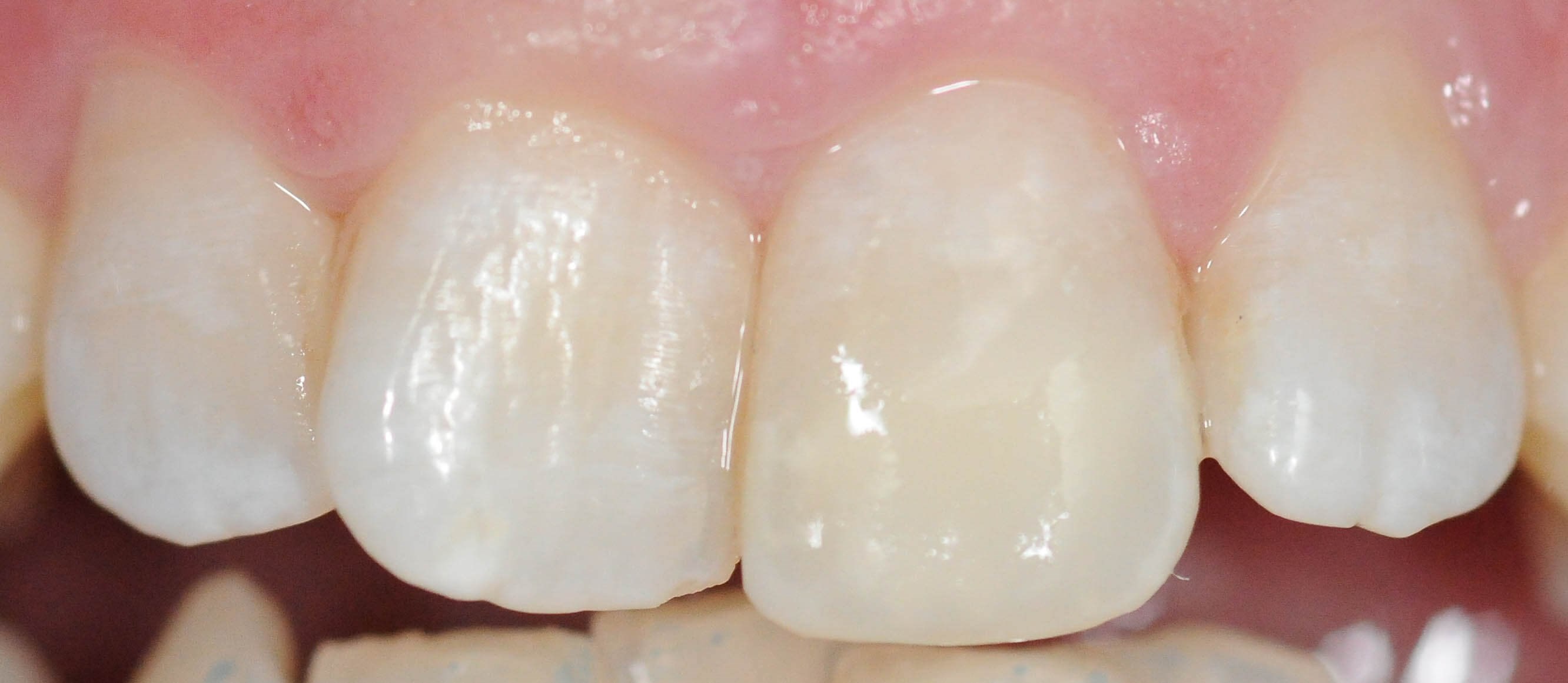 After Image
