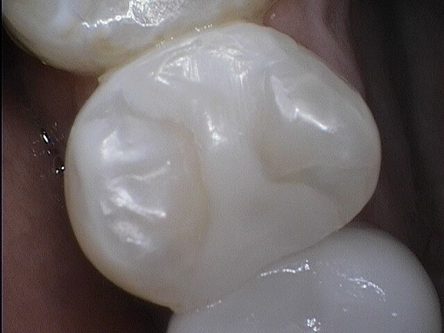After Image